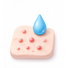 Acne-prone Skin