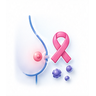 Advanced Breast Cancer
