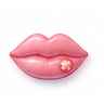 Cold Sores