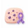 Kaposi Sarcoma