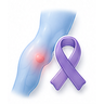 Soft Tissue Sarcoma