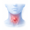 Strep Throat